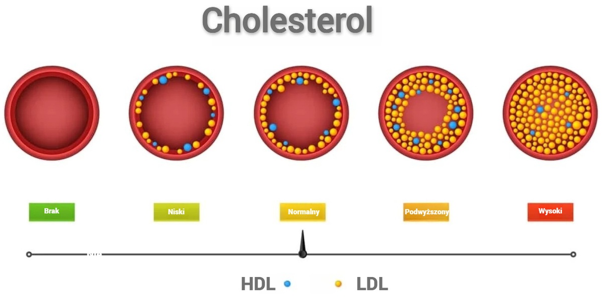 Normy cholesterolu