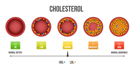 Dobry i zły cholesterol